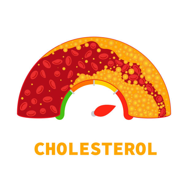 Cholestrol Diet Plan
