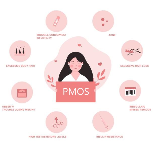 Common PMOS (PCOS) symptoms: irregular or missed periods, acne, excessive hair loss, excessive body hair, high testosterone levels, insulin resistance, trouble conceiving, and obesity or trouble losing weight